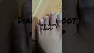 Diabetic foot fungus