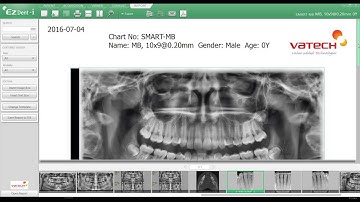 EZDent i, Chapter 05 03   Toolbar FINAL