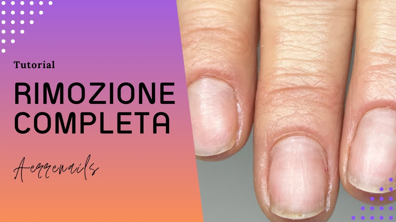 RIMOZIONE COMPLETA del SEMIPERMANENTE RINFORZATO