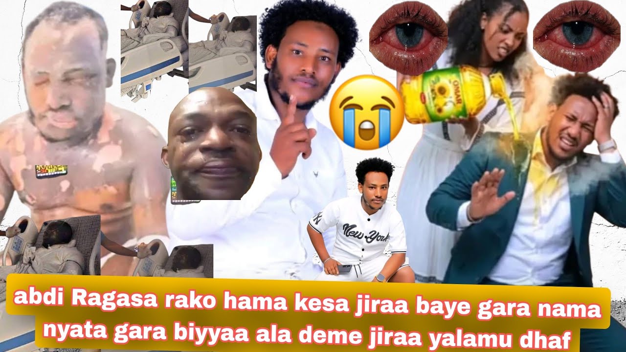 abdi Ragasa rako hama kesa jiraa baye gara nama nyata gara biyyaa ala deme jiraa yalamu dhaf😭