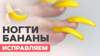 видео: Ногти БАНАНЫ | Как исправить дико клюющие ногти картинка: Ногти БАНАНЫ | Как исправить дико клюющие ногти