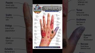 Common skin condition #trending #motivation #nursingstudent #reels #education#education #viral#nurse