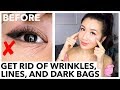 GET RID OF WRINKLES, LINES, DARK CIRCLES UNDER EYES