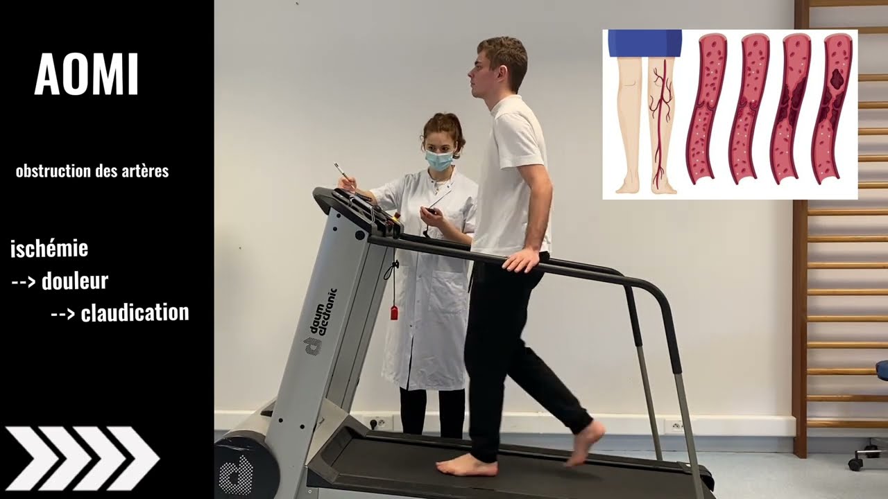 Examen du tapis roulant Sole F89 | Un bourreau de travail fiable pour les coureurs qui en veulent un peu plus