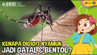 Penyebab Digigit Nyamuk Menjadi Gatal dan Bentol