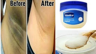 Cara Menghilangkan Ketiak Hitam dalam 3 Menit (hasil instan) dengan Vaseline 100% Efektif