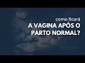 A VAGINA após o parto NORMAL // Dra. Jordanna Leão