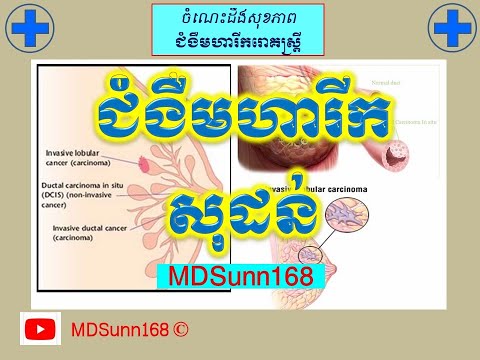 ជំងឺមហារីកសុដន់ រោគសញ្ញានិងវិធីបង្ការ l Symptoms and prevention of breast cancer l MDSunn168