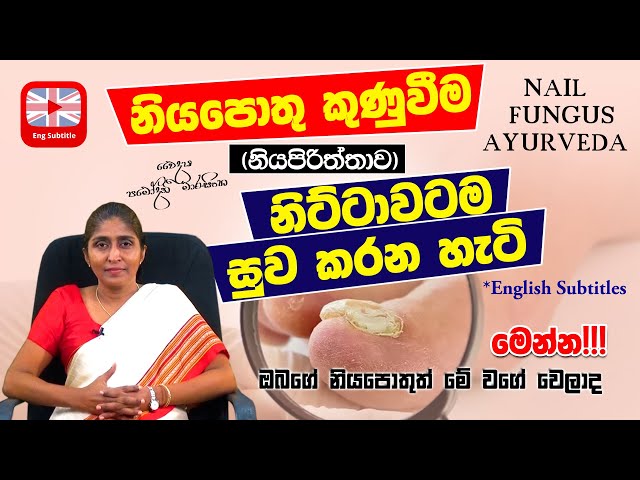 Fungal Nail Care Pack - Herbal Remedies for Fungal Nail Infection
