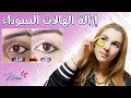 تخلصي بالكامل من السواد والانتفاخات تحت العين تخلصي بالكامل من السواد والانتفاخات تحت العين