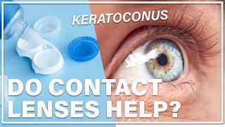 Can Contact Lenses Stop Keratoconus?