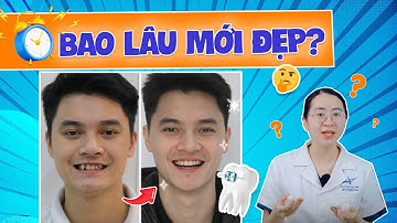 Thời Gian Niềng Răng: Yếu Tố Nào Ảnh Hưởng Đến Thời Gian Niềng Răng? (Ai Cũng Gặp Phải)