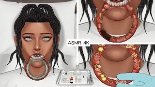 ASMR Treatment and removal of swelling caused by wearing large lip piercings | 염증 입술 치료 애니메이션