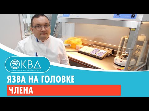 Видео: Язвы полового члена: что вызывает раны и пузыри на кончике или вале?