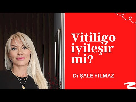 Video: Yüz Vitiligosunu Teşhis Etmenin ve Tedavi Etmenin 3 Kolay Yolu