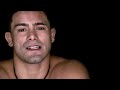 James Krause gets sick and tired of people asking about his eye | THE ULTIMATE FIGHTER