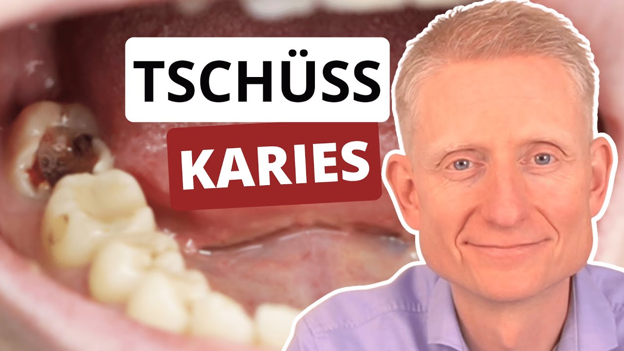 3 unbekannte Anti-Karies-Tipps (musst du kennen)