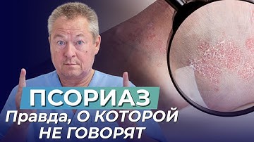 ПСОРИАЗ? ЛЕЧИТЕ КИШЕЧНИК, А НЕ КОЖУ! Правда, О КОТОРОЙ НЕ ГОВОРЯТ врачи!