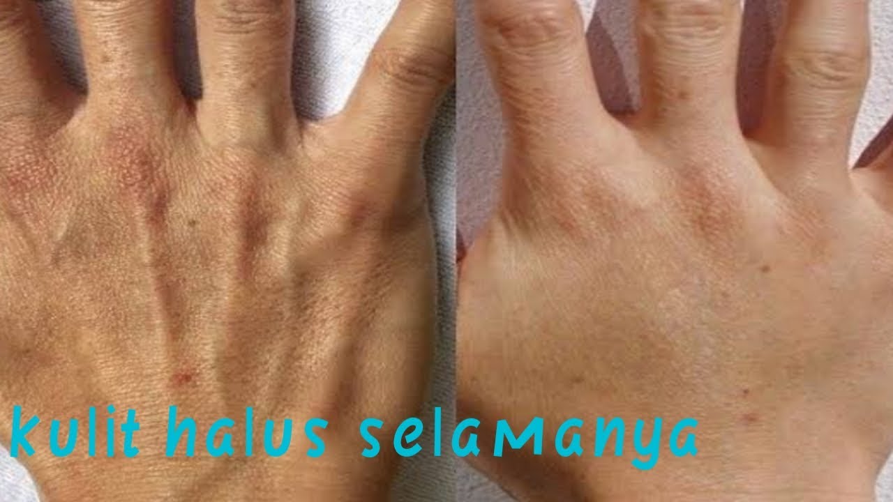 Cara menghaluskan kulit tangan dan badan
