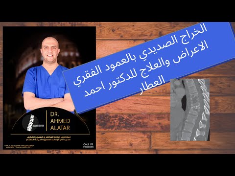 الالتهاب الفقاري الاسباب والعلاج - صديد الفقرات