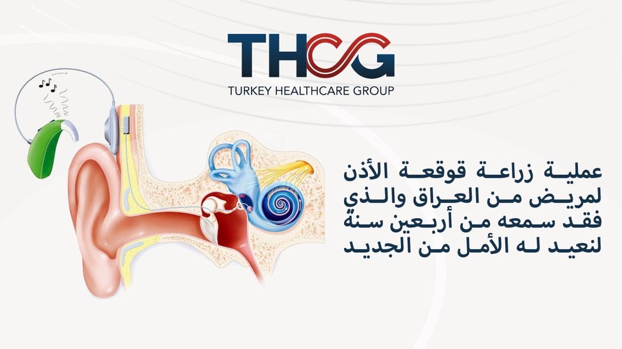 عملية زراعة قوقعة الأذن لمريض من العراق والذي فقد سمعه من أربعين سنة لنعيد له الأمل من الجديد