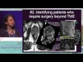 MRI in rectal cancer staging is mandatory