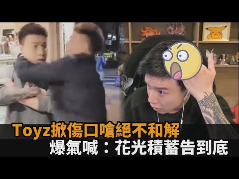 Toyz絕不和解！掀頭部傷口曝「永久性禿頭」 爆氣嗆：花光積蓄告到底－全民話燒