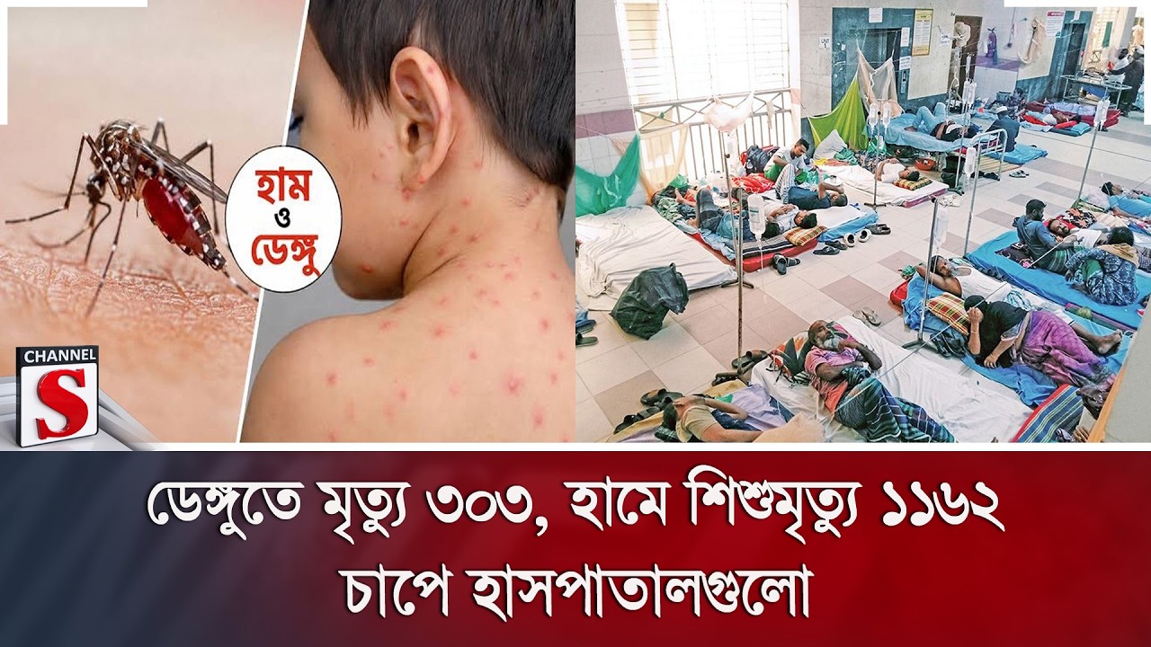 ডেঙ্গুতে মৃ/ত্যু ৩০৩, হামে শিশুমৃ/ত্যু ১১৬২; চাপে হাসপাতালগুলো | Channel S News