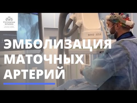 Эмболизация маточных артерий