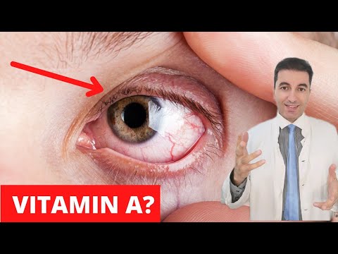 VELIKA OPASNOST ZBOG NEDOSTATKA VITAMINA A! Ovo je informacija koju morate znati...