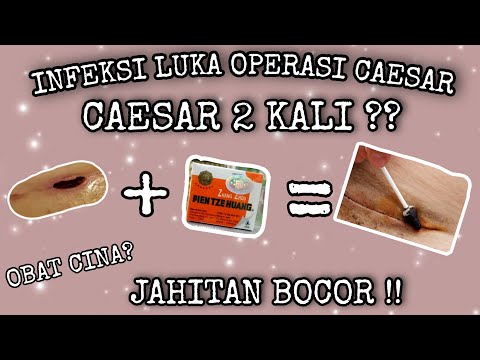 Video: Cara Mendapatkan Kembali Wang Untuk Operasi