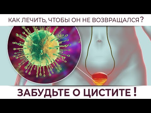 Forget about cystitis! How to properly treat cystitis to prevent it from coming back?