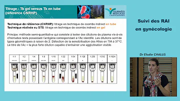 Pourquoi Rai positive ?