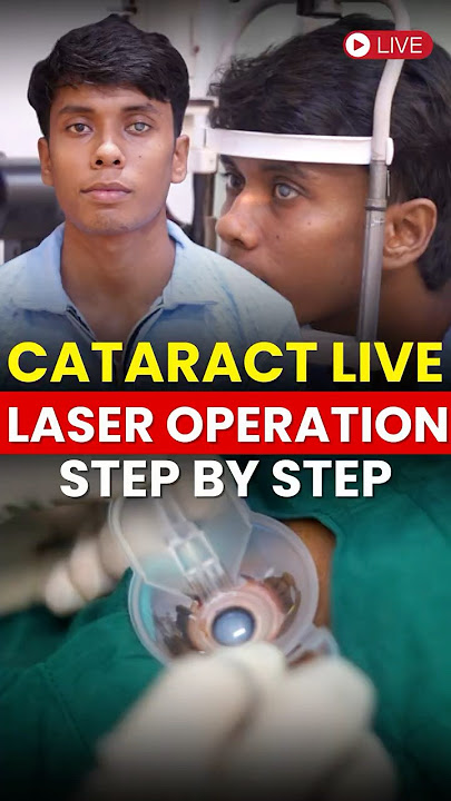Safest Cataract Live Laser Operation | Step by Step Surgery Guide✅