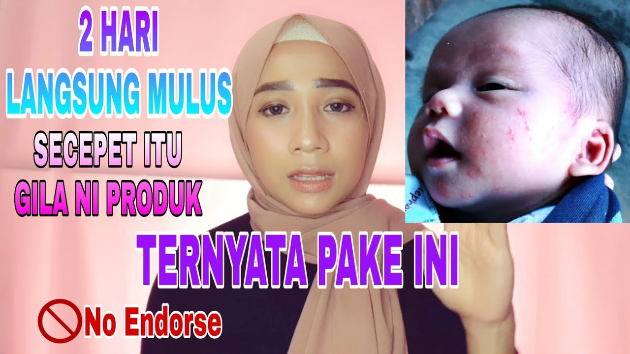 BRUNTUSAN HILANG DALAM 2 HARI | CARA CEPAT MENGHILANGKAN