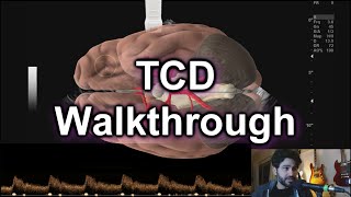 TCD Protocol Walkthrough