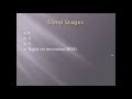 Sleep basics:  Wave form and sleep stages