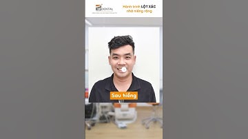 Hành trình LỘT XÁC nhờ niềng răng của Khai Trí