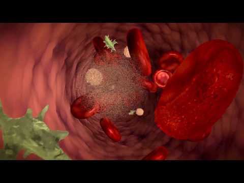 Video: Kas ir hematoloģiskais vēzis?