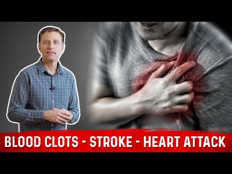 How to Avoid Blood Clots, a Stroke & Heart Attacks