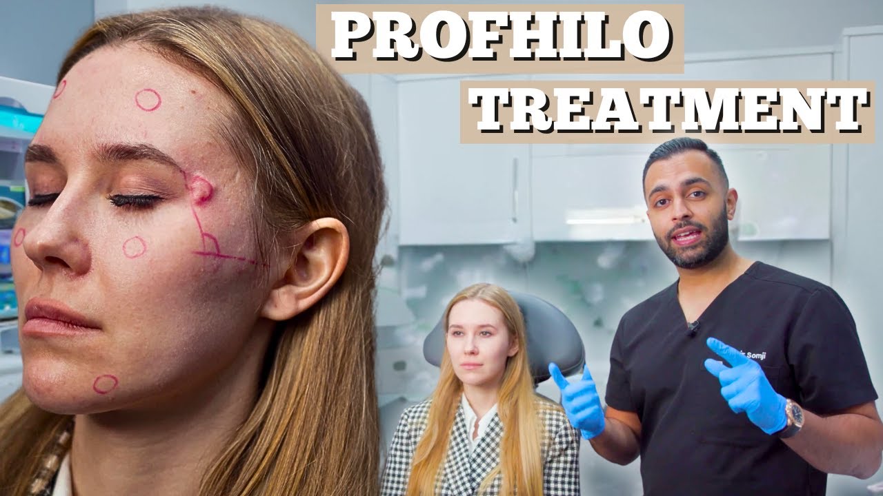 Profhilo Treatment | Dermal Filler For Fine Lines & Wrinkles | Dr. Somji & Dr. Solomon Demonstrate
