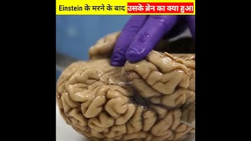 Einstein के मरने के बाद उनके ब्रेन के साथ क्या हुआ था 😱 जान लो सच्चाई 🔥#facts #shorts