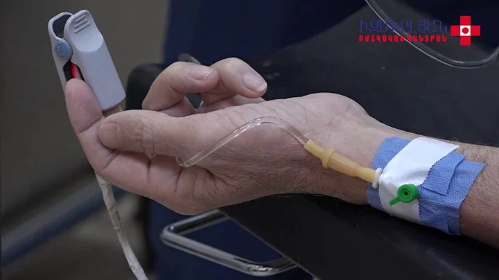 Հազվագյուտ կլինիկական դեպք. քար` արեհստածին աղիքից ծևավորված միզապարկում