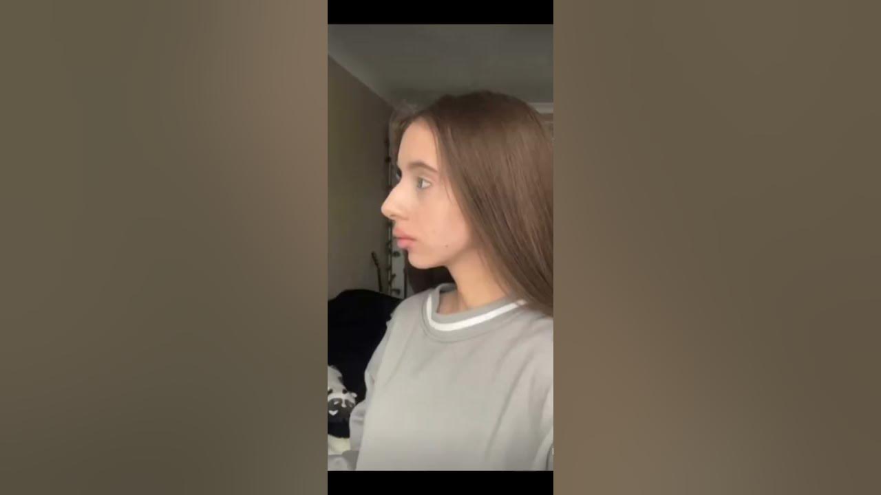 Лия Стеффи.нос ДО и ПОСЛЕ - YouTube
