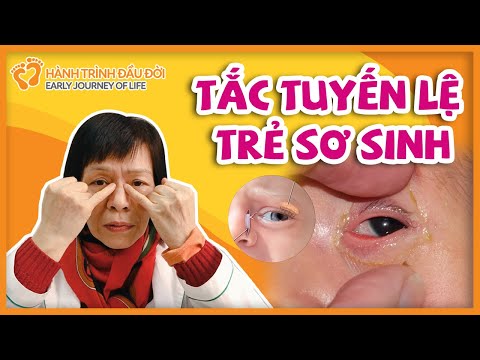 Video: Làm thế nào để loại bỏ sáp ướt khỏi tai bị nhiễm trùng