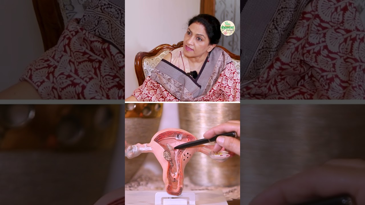 Fibroids।फाइब्राइड्स/रसौली क्या है, कैसे होता है इलाज। Dr. Lavleen Sodhi