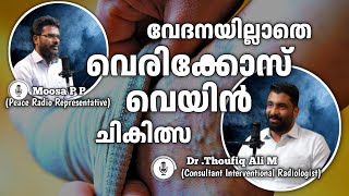 വേദനയില്ലാതെ "വെരിക്കോസ് വെയിൻ ചികിത്സ” | Dr Thoufiq Ali M | Moosa P.P. | Arogya Vijaram