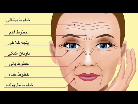 تصویری: چین و چروک های صورت در مورد چه چیزی می توانند بگویند؟