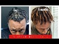 Dreadlock journey * 1-6 month *dread update