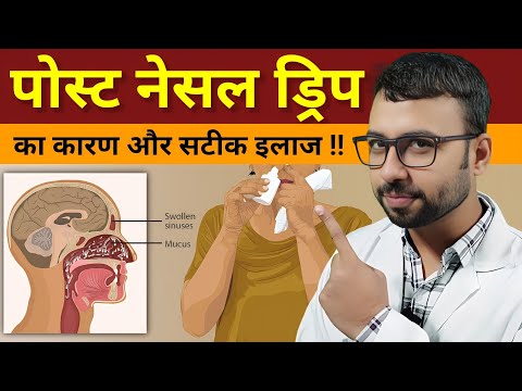 वीडियो: पोस्ट नेज़ल ड्रिप को ठीक करने के 3 तरीके